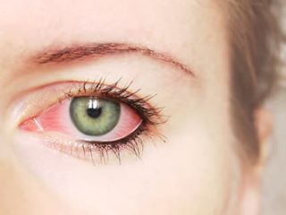facts about dry eye