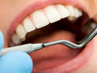 how to fix a dental cavity